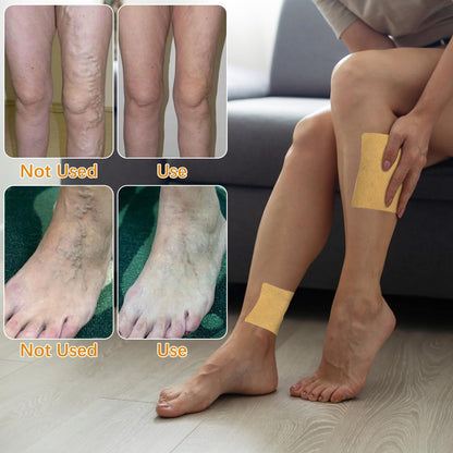 🦵Turmeric Varicose Vein Patch – A Natural Breakthrough for Vein Health! 🌿🦵