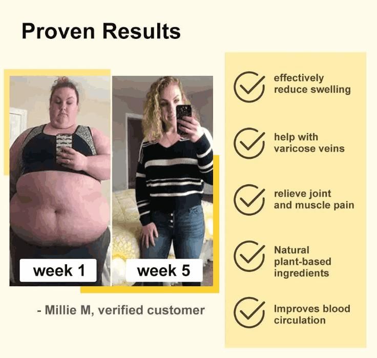 Bee Venom Lymphatic Drainage & Slimming Foot Patches 🌿👣